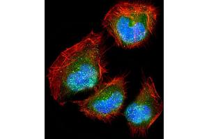Image no. 3 for anti-delta Like Protein 3 (DLL3) (AA 519-548), (C-Term) antibody (ABIN653276)