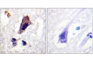 Immunohistochemistry analysis of paraffin-embedded human brain, using PIP5K (Phospho-Ser307) Antibody.