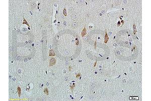 Image no. 1 for anti-Nerve Growth Factor beta (NGFB) (AA 151-220) antibody (ABIN724430)