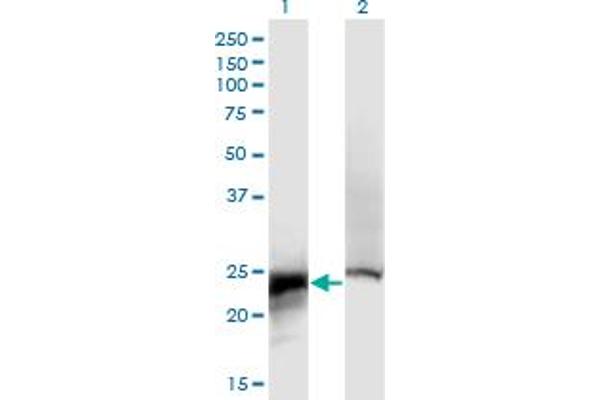 CRYbB2 antibody  (AA 1-205)