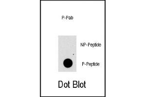 Image no. 2 for anti-Fibroblast Growth Factor Receptor 1 (FGFR1) (pTyr766) antibody (ABIN358128)