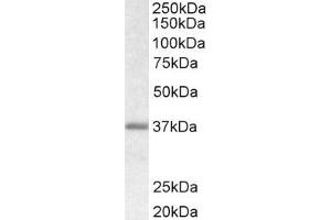 Image no. 1 for anti-Biglycan (BGN) (C-Term) antibody (ABIN334359)
