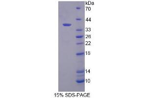 Image no. 1 for Regulator of G-Protein Signaling 9 (RGS) (AA 1-296) protein (His tag) (ABIN6239414)