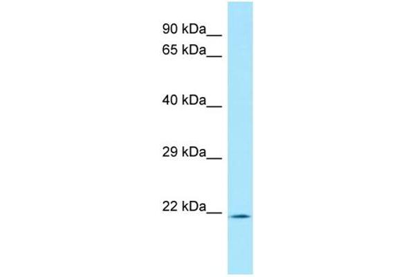 anti-Acireductone Dioxygenase 1 (ADI1) (Middle Region) antibody