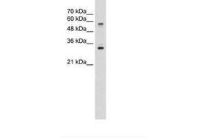 Image no. 2 for anti-Solute Carrier Family 22 (Organic Cation Transporter), Member 1 (SLC22A1) (C-Term) antibody (ABIN203397)