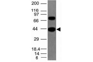 Image no. 5 for anti-Pan Muscle Actin antibody (ABIN3026683)