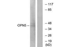 Image no. 2 for anti-Opsin 5 (OPN5) (AA 251-300) antibody (ABIN1535847)
