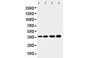 HSD17B1 Antikörper  (N-Term)