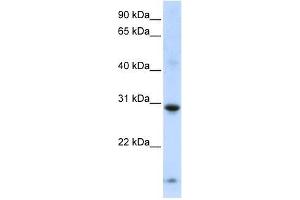 Image no. 1 for anti-Zinc Finger Protein 138 (ZNF138) (Middle Region) antibody (ABIN928176)