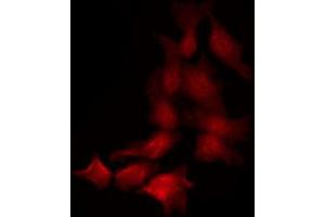 Image no. 4 for anti-Janus Kinase 1 (JAK1) (pTyr1022), (pTyr1023) antibody (ABIN6255762)