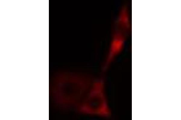 anti-Heat Shock 70kDa Protein 9 (Mortalin) (HSPA9) (C-Term) antibody