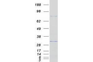 Image no. 1 for DEAD (Asp-Glu-Ala-Asp) Box Polypeptide 50 (DDX50) protein (Myc-DYKDDDDK Tag) (ABIN2719287)