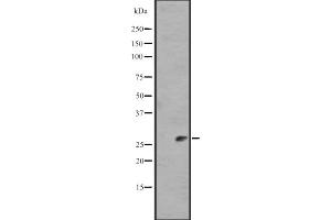 Image no. 1 for anti-Interleukin 11 (IL11) (N-Term) antibody (ABIN6257286)