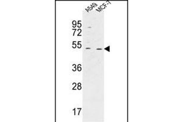 C14orf94 antibody  (C-Term)