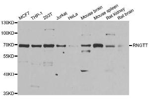 Image no. 1 for anti-RNA Guanylyltransferase and 5'-Phosphatase (RNGTT) antibody (ABIN6147053)