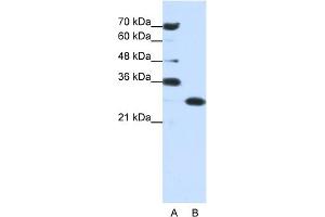 Image no. 1 for anti-Acidic (Leucine-Rich) Nuclear phosphoprotein 32 Family, Member A (ANP32A) (Middle Region) antibody (ABIN2778667)