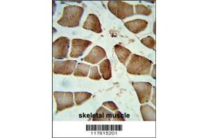 Immunohistochemistry (IHC) image for anti-Coiled-Coil Domain Containing 85B (CCDC85B) antibody (ABIN2158086)