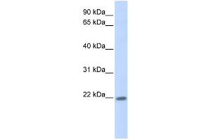 Image no. 1 for anti-Zinc Finger Protein 534 (ZNF534) (Middle Region) antibody (ABIN2775149)