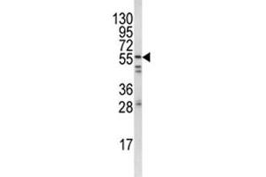 Image no. 4 for anti-FYN Oncogene Related To SRC, FGR, YES (FYN) (AA 1-30) antibody (ABIN3031010)