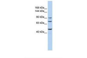 Image no. 1 for anti-UDP-N-Acetyl-alpha-D-Galactosamine:polypeptide N-Acetylgalactosaminyltransferase 5 (GalNAc-T5) (GALNT5) (AA 701-750) antibody (ABIN6738301)