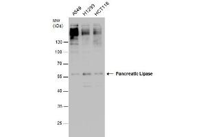 Image no. 2 for anti-Pancreatic Lipase (PNLIP) (Center) antibody (ABIN2856717)