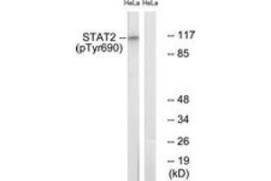 Western blot analysis of extracts from HeLa cells treated with IFN 2500U/ml 30', using STAT2 (Phospho-Tyr690) Antibody.