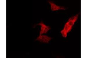 Image no. 3 for anti-MAP/microtubule Affinity-Regulating Kinase 2 (MARK2) antibody (ABIN6258272)