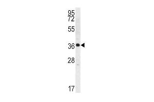 Image no. 1 for anti-Kallikrein 2 (KLK2) (AA 166-197), (C-Term) antibody (ABIN1536788)