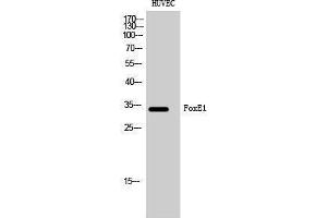 Image no. 1 for anti-Forkhead Box E1 (Thyroid Transcription Factor 2) (FOXE1) (N-Term) antibody (ABIN3184656)