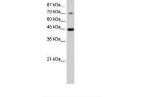 Image no. 2 for anti-Splicing Factor 3b, Subunit 4, 49kDa (SF3B4) (N-Term) antibody (ABIN202492)