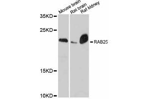 Image no. 1 for anti-RAB25, Member RAS Oncogene Family (RAB25) antibody (ABIN6290827)