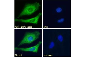 Image no. 1 for anti-Tumor Necrosis Factor (Ligand) Superfamily, Member 14 (TNFSF14) (Internal Region) antibody (ABIN571046)