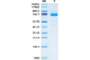 IL20RA Protein (Fc Tag)