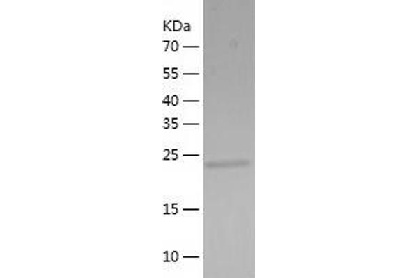 METTL11A Protein (AA 1-223) (His tag)