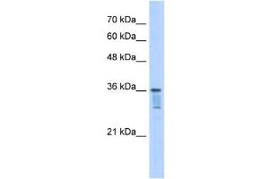Image no. 1 for anti-Leucine Zipper Transcription Factor-Like 1 (LZTFL1) (C-Term) antibody (ABIN629864)
