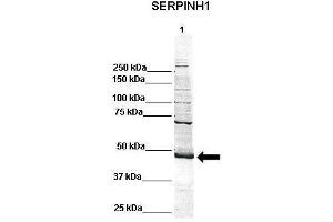 Image no. 4 for anti-serpin Peptidase Inhibitor, Clade H (Heat Shock Protein 47), Member 1, (Collagen Binding Protein 1) (SERPINH1) (C-Term) antibody (ABIN2792207)