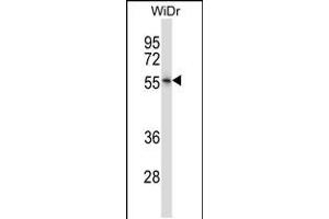 Image no. 1 for anti-Nuclear Receptor Subfamily 2, Group E, Member 3 (NR2E3) (AA 170-198) antibody (ABIN5531935)
