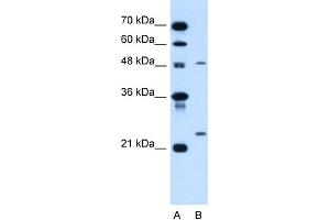 Image no. 1 for anti-Sphingomyelin phosphodiesterase 2, Neutral Membrane (Neutral Sphingomyelinase) (SMPD2) (N-Term) antibody (ABIN2782209)