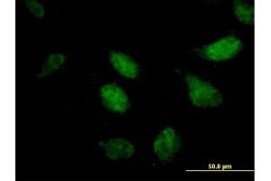 Image no. 2 for anti-Zinc Finger Protein 296 (ZNF296) (AA 1-475) antibody (ABIN531130)