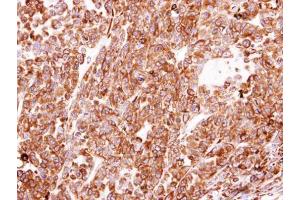 IHC-P Image Immunohistochemical analysis of paraffin-embedded H520 xenograft, using PDI, antibody at 1:100 dilution.