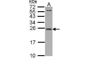 Image no. 1 for anti-Interleukin 1 Receptor Antagonist (IL1RN) (Center) antibody (ABIN2856394)