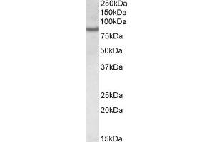 Image no. 2 for anti-CREB Regulated Transcription Coactivator 2 (CRTC2) (AA 83-96) antibody (ABIN625819)