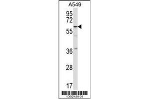 Image no. 1 for anti-Transcription Factor CP2-Like 1 (TFCP2L1) (AA 342-370), (C-Term) antibody (ABIN657361)