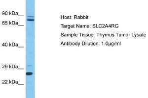 Image no. 1 for anti-SLC2A4 Regulator (SLC2A4RG) (C-Term) antibody (ABIN2781090)