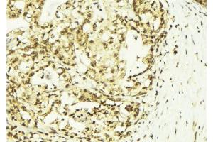 Image no. 1 for anti-Sjogren Syndrome Nuclear Autoantigen 1 (SSNA1) (N-Term) antibody (ABIN6263506)