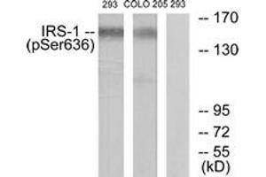 Image no. 1 for anti-Insulin Receptor Substrate 1 (IRS1) (AA 603-652), (pSer636) antibody (ABIN1531878)