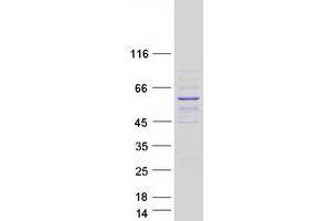 Image no. 1 for Spermatogenesis and Oogenesis Specific Basic Helix-Loop-Helix 2 (SOHLH2) protein (Myc-DYKDDDDK Tag) (ABIN2732348)