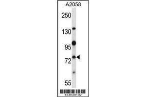 Image no. 2 for anti-NIMA-Related Kinase 8 (NEK8) (AA 519-547), (C-Term) antibody (ABIN657848)