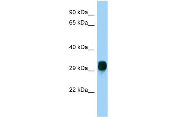 anti-F-Box Protein 17 (FBXO17) (N-Term) antibody