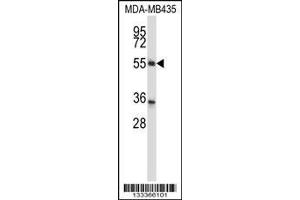 Image no. 1 for anti-Zinc Finger Protein 222 (ZNF222) (AA 1-30), (N-Term) antibody (ABIN657406)